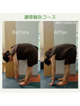 諏訪の杜鍼灸院/全身鍼灸