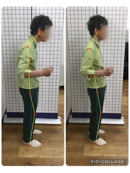 ボディメイク整体院 横浜駅西口店(BodyMake)/施術風景-姿勢改善希望の女性-