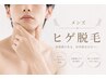 【メンズ脱毛】ヒゲ脱毛　2000円！
