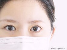 グルス(GRUS)/Wプロテクトカール