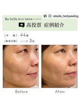 シュリー(Sriii)/リベル効果コンテスト☆高投票