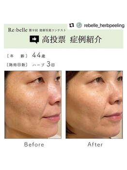 シュリー(Sriii)/リベル効果コンテスト☆高投票