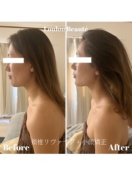 ルルボーテ(Loulou Beaute)/頚椎リヴァイブ&小顔矯正