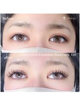 スウィートアイズ(Sweet eyes)/LEDバインドロック120束