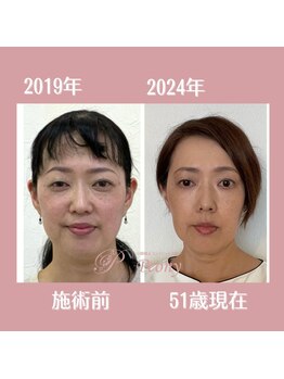 ピオニー(Peony)/5年前の私と2024年現在の私