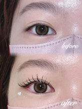 アテプラス(ate+)/アンドヘルシー