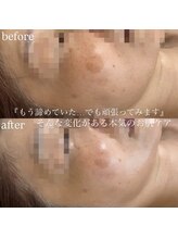 ビューティーサロン プティ(beauty salon petite)/ハーブ/ポレーション/しみケア