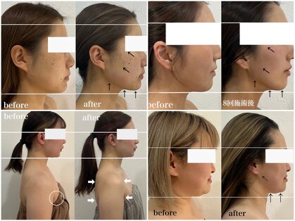 ベール(BEHL)の写真
