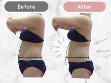 ミネット(minette)の雰囲気（ぽっこりお腹もすっきり！）