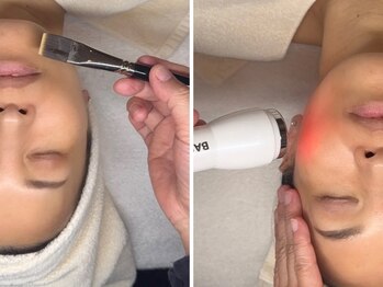 ミーツ(Meets)の写真/鏡を見るたび気になるシミにアプローチ！変化を実感できるケアを届けます。一人で悩まず、あきらめないで。