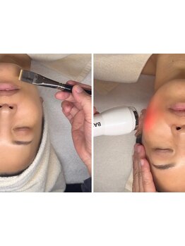 シミしわ改善！予防ケア