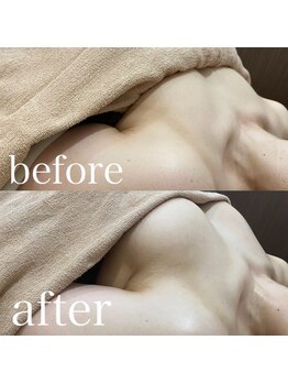 ディーソワン(De-soin)/