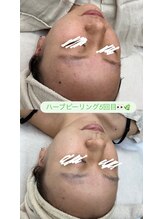 メリアミーゴ(Meli amigo)