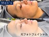 【新規】メンズ/フェイシャル｜IPL光フォト＋毛穴洗浄エイジングケア 60分