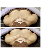 ティアラ(Tiara)/左右差が気になる方にオススメ！