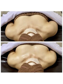 ティアラ(Tiara)/左右差が気になる方にオススメ！