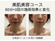 ジェム鍼灸サロン 横浜元町(gem鍼灸サロン)/人気NO２！美肌美容BefoerAfter