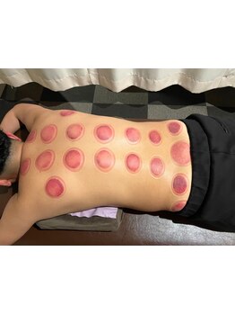 疲れを解消したい