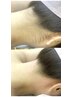 Mパーツ脱毛→うなじ/Ｖ/Ｉ/肘下表/肘上表/膝下表/膝上表→1箇所お選び下さい