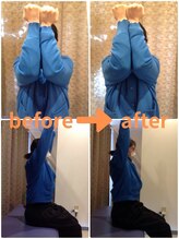 若松整体院/ビフォーアフター(1)