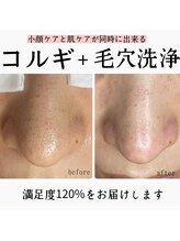 ヌナ(nuna)/小顔と美肌が叶う☆