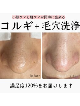 ヌナ(nuna)/小顔と美肌が叶う☆