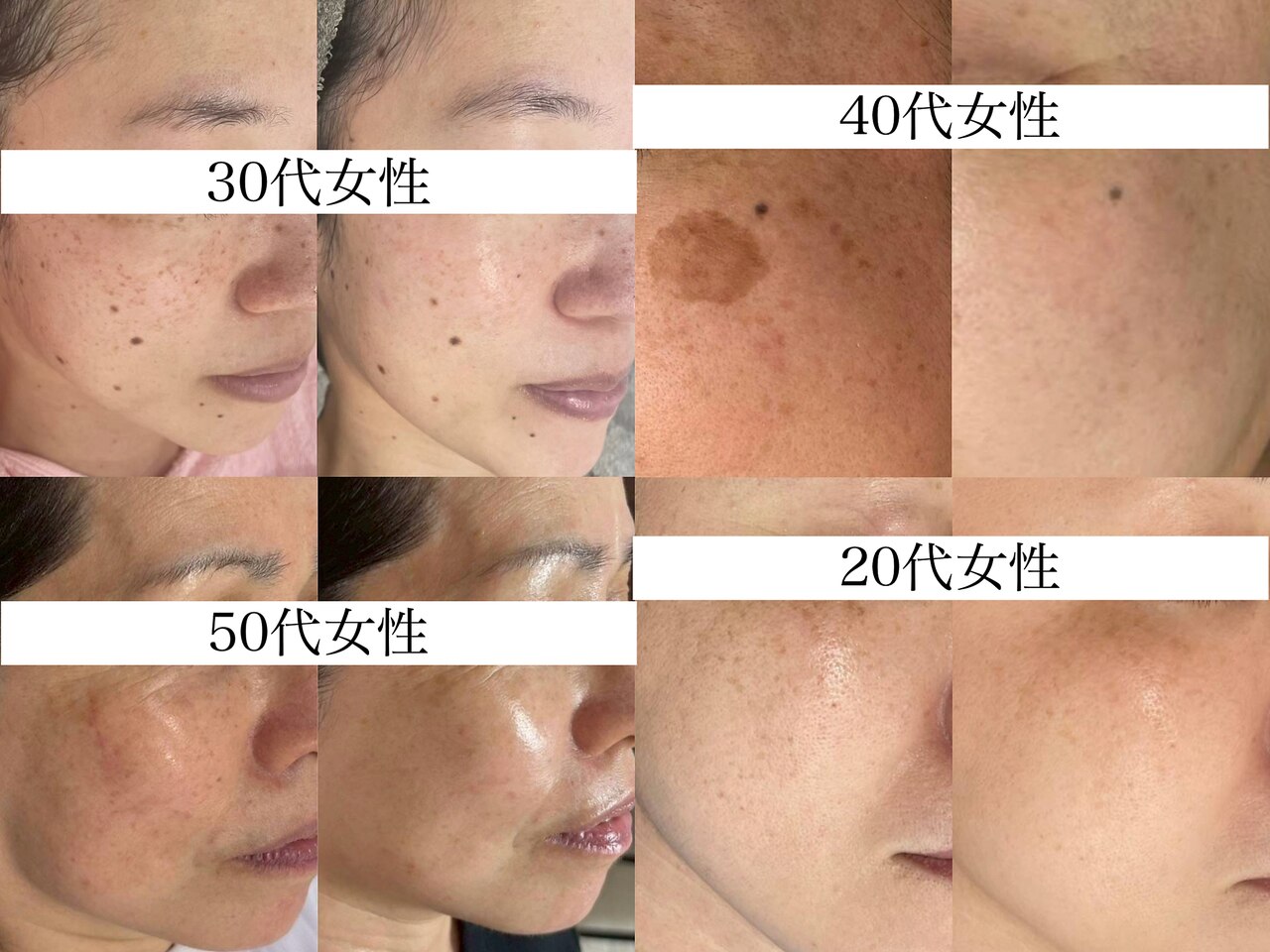 値下げしました！エステサロン　EMS 厳選】顔のケアにおすすめのEMSをランキングから探す≪エステサロン