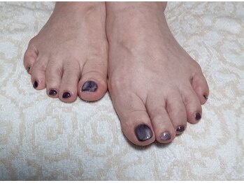 イーズ(ease)/マグネット　フット