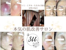 スー(su:)