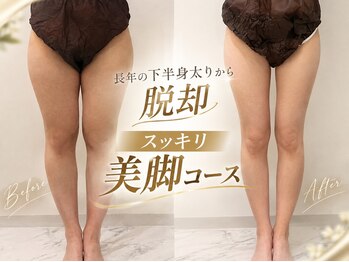 プシュケ(PSYCHE)の写真/【脚・太もも・ヒップ】下半身太りの原因は冷えむくみ、血流改善でスッキリ美脚に◎