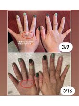 リモアボーテ(RIMOA beaute)/【エルピュア】before→after