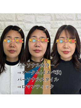 アマテラス(AMATERAS)/オーラの美容○形♪♪