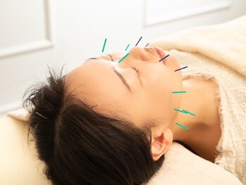 ココチ 中央林間(salon cocochi)/大人気!美容鍼♪