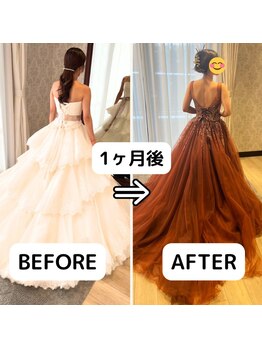 アミーゴ整体院/ビフォーアフター