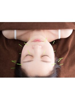 鍼灸施術を受けたい