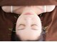 エモーション(Emotion)の写真/“美肌・小顔・透明感”が手に入る！家資格保有の女性鍼灸師による美顔美容鍼で肌悩みを根本から改善★