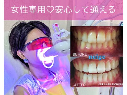 ネージュ(neige)の写真