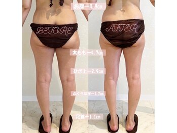 デジール(DESIR)/【痩身】全身+脚痩　６カ月