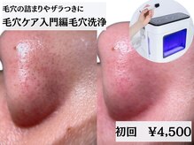あすはれ