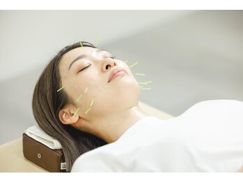 長崎中央整骨院 鍼灸院の写真/美容認定された有資格者による【本格美容鍼灸¥2200】身体の全部のバランスを整える満足度No.1コース☆