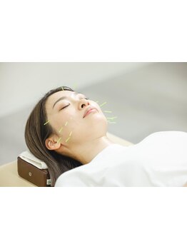 鍼灸施術を受けたい