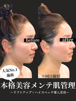 ノーブルノアール(Noble noir)/本格メンテでたるみケア×肌管理