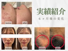 ビープラス(BEE PLUS)