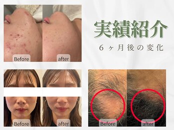 ビープラス(BEE PLUS)