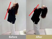 せなかのはね 井尻店/30代　女性　猫背　肩こり