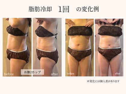 ビーサロン(B-salon)の写真
