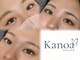カノアアイラッシュ(Kanoa Eyelash)の写真