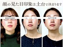 ミラ 長崎駅前店(MIRA)の雰囲気（諦めていたお顔の悩みは正しい方法で改善できます。 長崎_小顔）