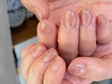 アメリアンドカシェット(Amelie&Cachette)/ウェディングネイル:maika