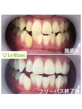 ルブラン 奈良店(Le Blanc)/女性も負けてられませんよ!!